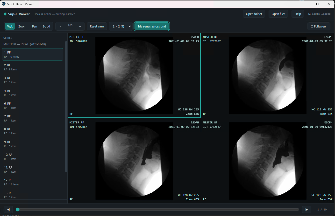 HTML Sup-C Dicom Viewer in a browser