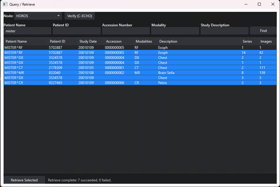 Sup-C Dicom Viewer displaying CT images