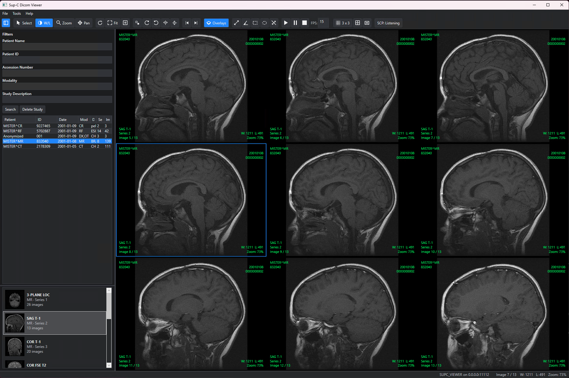Sup-C Dicom Viewer displaying MR images in a multi-image layout